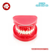 Bộ mô hình hàm răng Bộ mô hình hàm răng